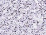 HIST2H2BE Antibody in Immunohistochemistry (Paraffin) (IHC (P))