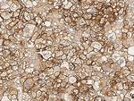 HLA-ABC Antibody in Immunohistochemistry (Paraffin) (IHC (P))