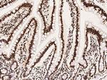 hnRNP M Antibody in Immunohistochemistry (Paraffin) (IHC (P))