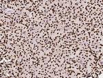 hnRNP M Antibody in Immunohistochemistry (Paraffin) (IHC (P))