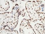 HSF1 Antibody in Immunohistochemistry (Paraffin) (IHC (P))