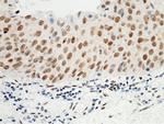 HSF1 Antibody in Immunohistochemistry (Paraffin) (IHC (P))