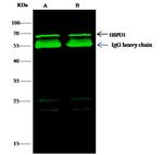 HSP60 Antibody in Immunoprecipitation (IP)