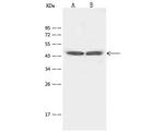 HTR4 Polyclonal Antibody