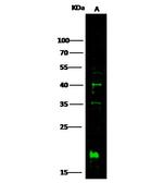IL10RB Polyclonal Antibody