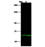 IL12RB1 Polyclonal Antibody