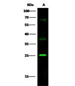ST2 Polyclonal Antibody