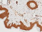 IL1RA Antibody in Immunohistochemistry (Paraffin) (IHC (P))