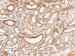 IL1RA Antibody in Immunohistochemistry (Paraffin) (IHC (P))