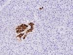 Insulin Polyclonal Antibody