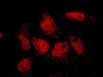 ISL2 Polyclonal Antibody