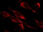 ITGB1 Antibody in Immunocytochemistry (ICC/IF)