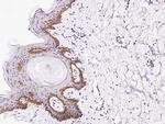 ITGB1 Antibody in Immunohistochemistry (Paraffin) (IHC (P))