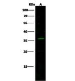 KChIP3 Polyclonal Antibody