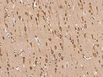 KBP Antibody in Immunohistochemistry (Paraffin) (IHC (P))