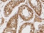 KBP Polyclonal Antibody