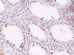 KLF17 Antibody in Immunohistochemistry (Paraffin) (IHC (P))
