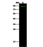 KLHL32 Antibody in Western Blot (WB)
