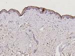 Kallikrein 7 Polyclonal Antibody