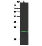 NKG2E Polyclonal Antibody