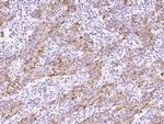 Cytokeratin 6C Antibody in Immunohistochemistry (Paraffin) (IHC (P))