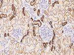 KRT76 Polyclonal Antibody