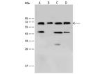 L-Plastin Antibody in Western Blot (WB)