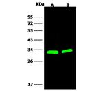 Galectin 3 Polyclonal Antibody
