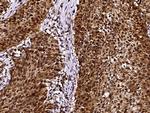 LSM1 Antibody in Immunohistochemistry (Paraffin) (IHC (P))