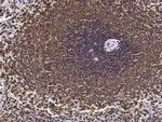 LSP1 Antibody in Immunohistochemistry (Paraffin) (IHC (P))