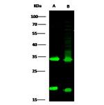 Latexin Polyclonal Antibody