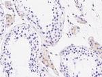 LY6K Polyclonal Antibody