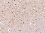 LC3A Polyclonal Antibody