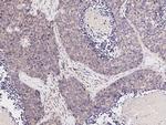 JNK2 Antibody in Immunohistochemistry (Paraffin) (IHC (P))