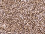 JNK2 Antibody in Immunohistochemistry (Paraffin) (IHC (P))