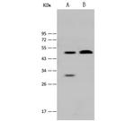 MBD2 Polyclonal Antibody