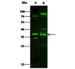 MBD3 Polyclonal Antibody