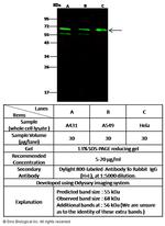 MDMX Polyclonal Antibody