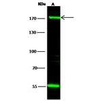 EVI1 Antibody in Western Blot (WB)