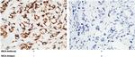 MICA Polyclonal Antibody