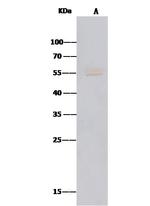 MICA Antibody in Immunoprecipitation (IP)