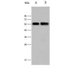 MICB Polyclonal Antibody