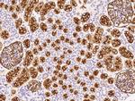 CD10 Antibody in Immunohistochemistry (Paraffin) (IHC (P))