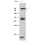 CD10 Antibody in Western Blot (WB)