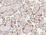 MMP26 Antibody in Immunohistochemistry (Paraffin) (IHC (P))