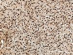 MRTO4 Antibody in Immunohistochemistry (Paraffin) (IHC (P))