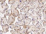 MSI2 Polyclonal Antibody