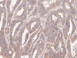 MUC5AC Antibody in Immunohistochemistry (Paraffin) (IHC (P))