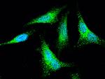 SNAP alpha/beta Polyclonal Antibody