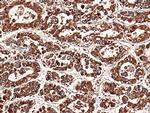 NBL1 Polyclonal Antibody